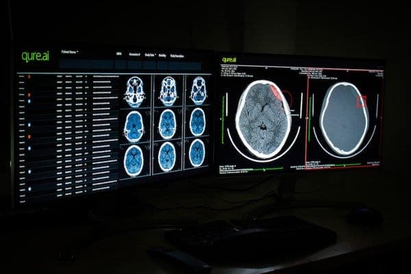 Qure.AI eyes IPO after hitting profitability